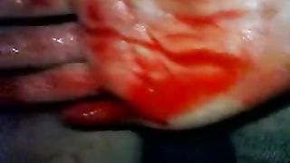 Bloody Fisting Porn - Fisting a bloody pussy hard